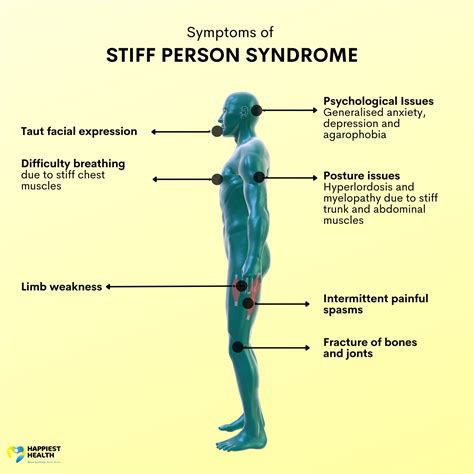 stiff person syndrome symptoms and signs.